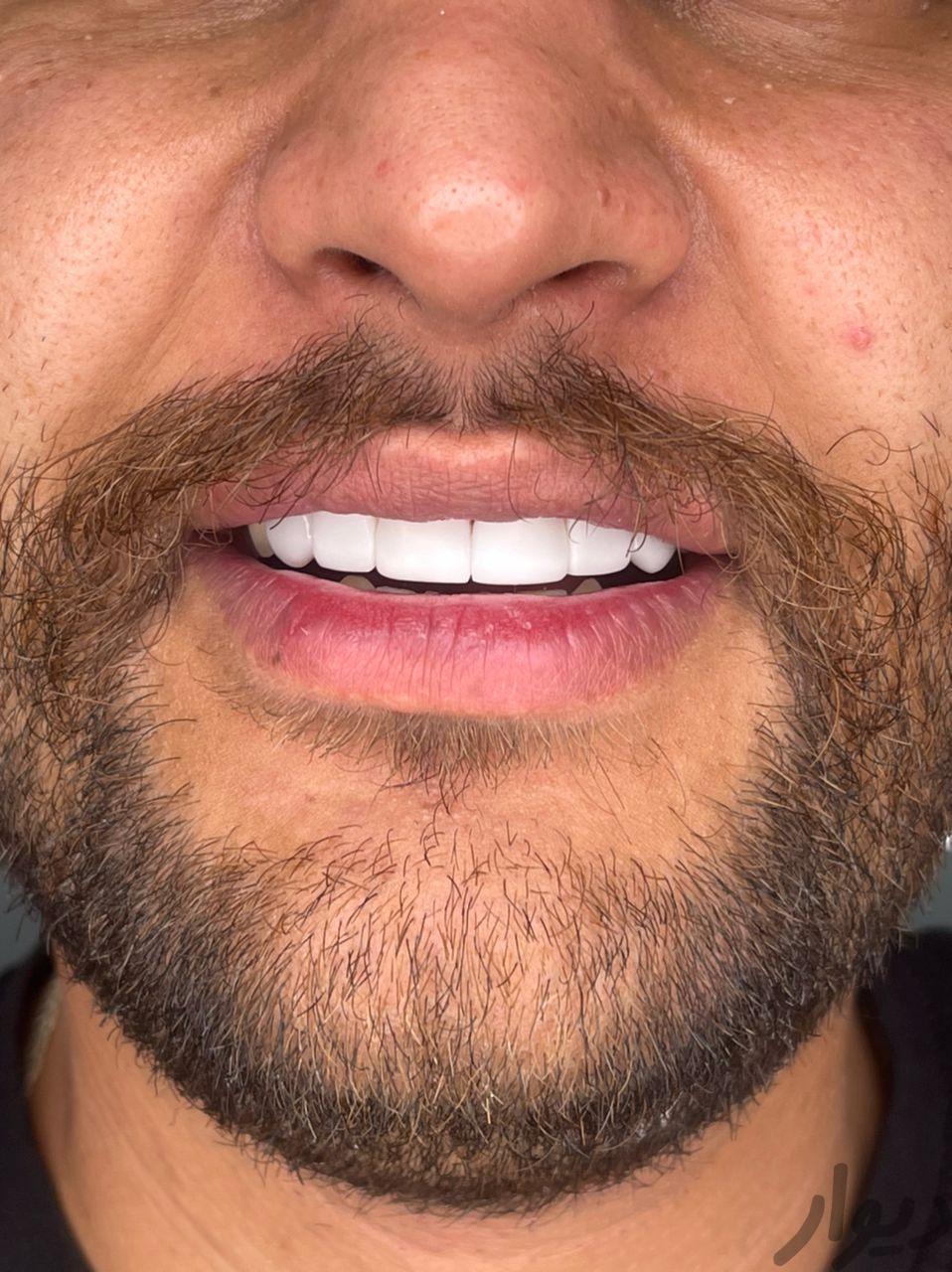 نیاز به همکار دندانپزشک